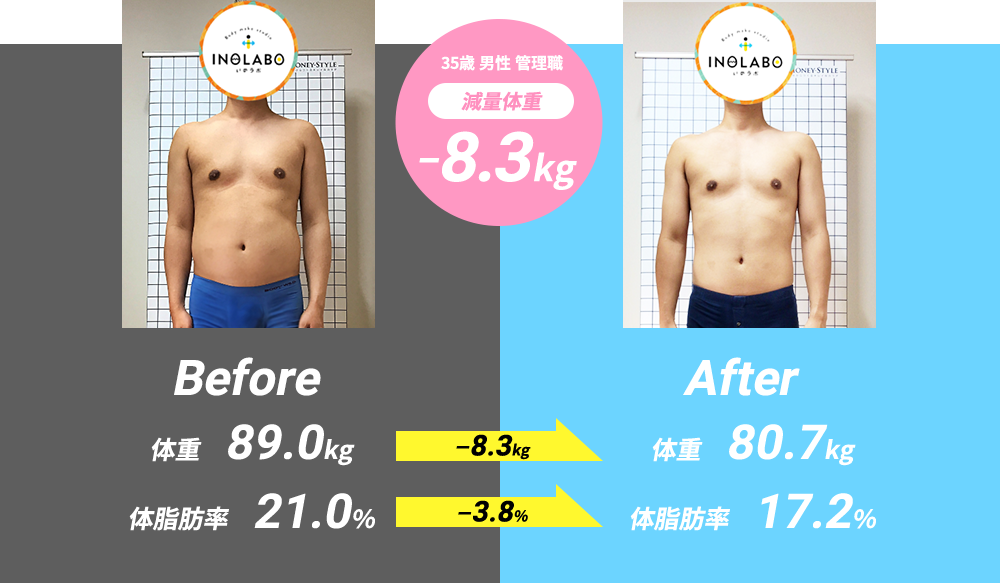 ビフォーアフター